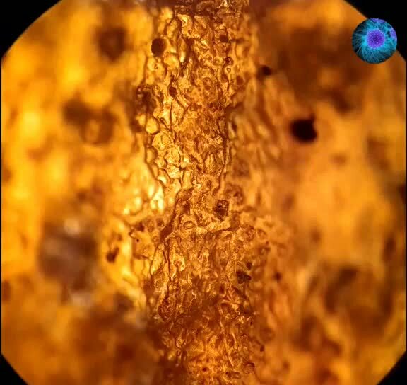 Съедобное золото | Медисследования | Максим Герасимов, 05 августа 2023